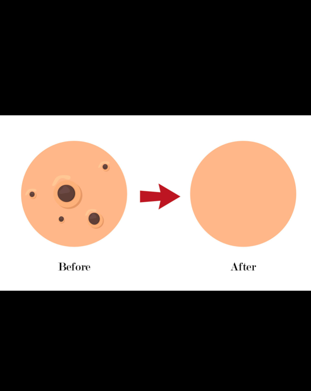 Witch Hazel Hydrosol 🌼 Pure (alcohol free,steam distilled, premium)